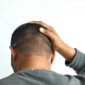 why does the back of my head hurt